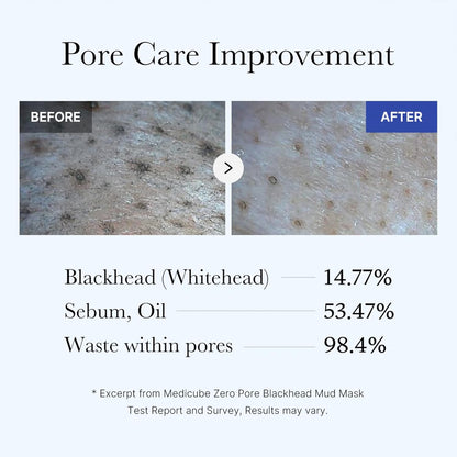 Zero Pore Blackhead Mud Mask | 3 min mud mask | pore care | Strong Blackhead Absorption